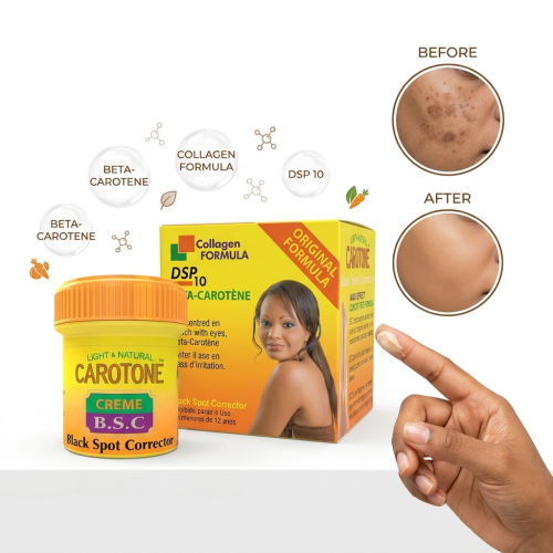 Carotone BSC Cream 30ml